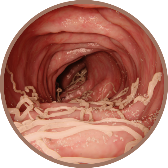 Roundworms